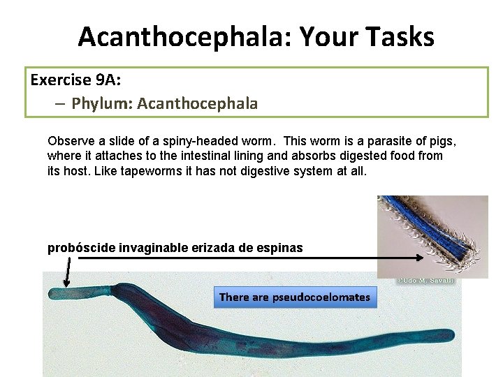 Acanthocephala: Your Tasks Exercise 9 A: – Phylum: Acanthocephala Observe a slide of a