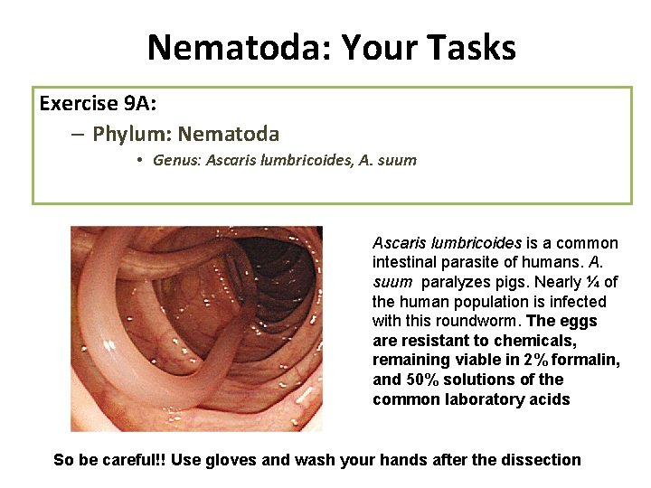 Nematoda: Your Tasks Exercise 9 A: – Phylum: Nematoda • Genus: Ascaris lumbricoides, A.