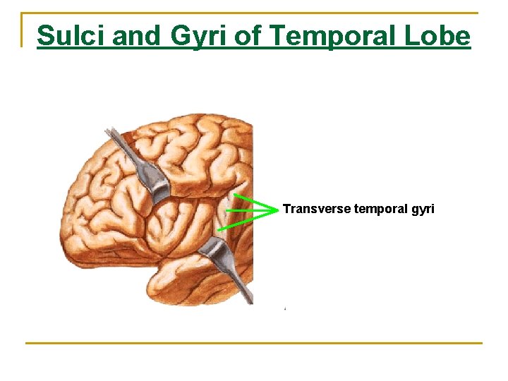 Sulci and Gyri of Temporal Lobe Transverse temporal gyri 