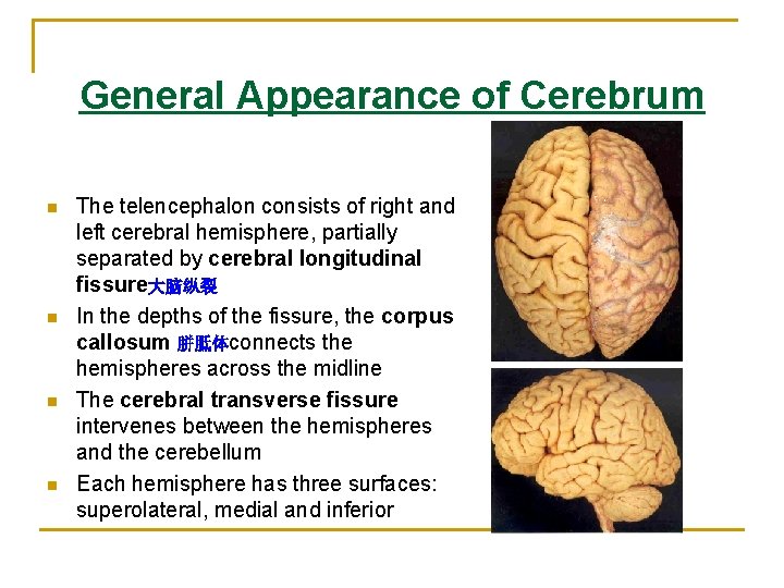 General Appearance of Cerebrum n n The telencephalon consists of right and left cerebral