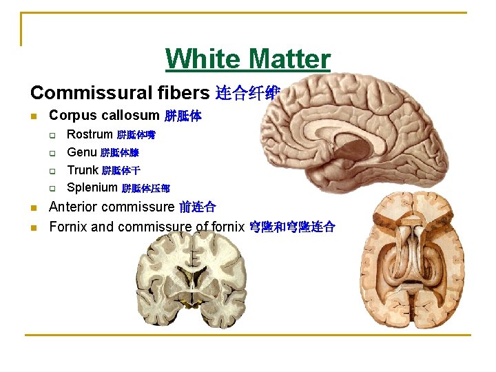 White Matter Commissural fibers 连合纤维 n Corpus callosum 胼胝体 q q n n Rostrum