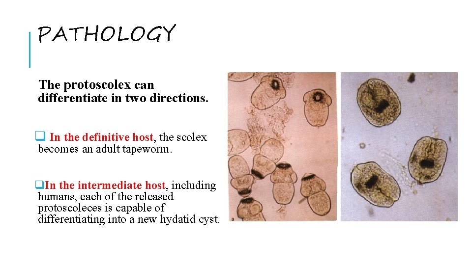 PATHOLOGY The protoscolex can differentiate in two directions. q In the definitive host, the