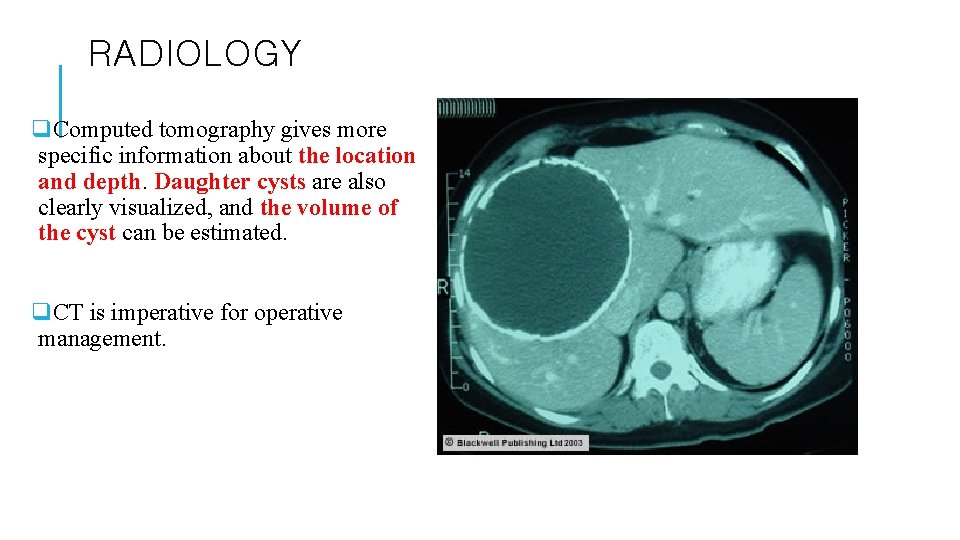 RADIOLOGY q. Computed tomography gives more specific information about the location and depth. Daughter