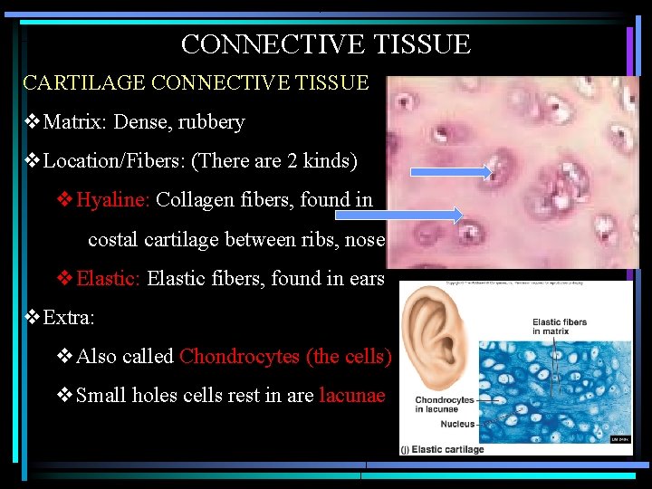 CONNECTIVE TISSUE CARTILAGE CONNECTIVE TISSUE v. Matrix: Dense, rubbery v. Location/Fibers: (There are 2