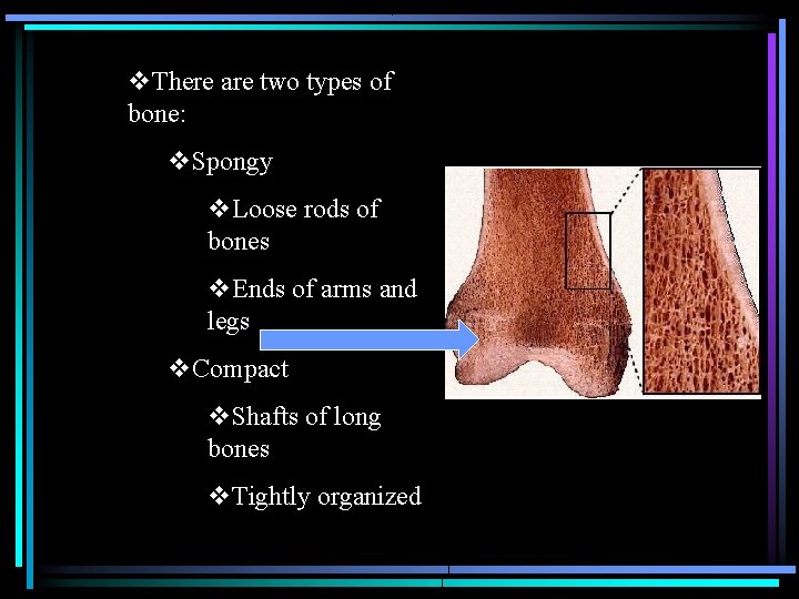 v. There are two types of bone: v. Spongy v. Loose rods of bones v. There are two types of bone: v. Spongy v. Loose rods of bones