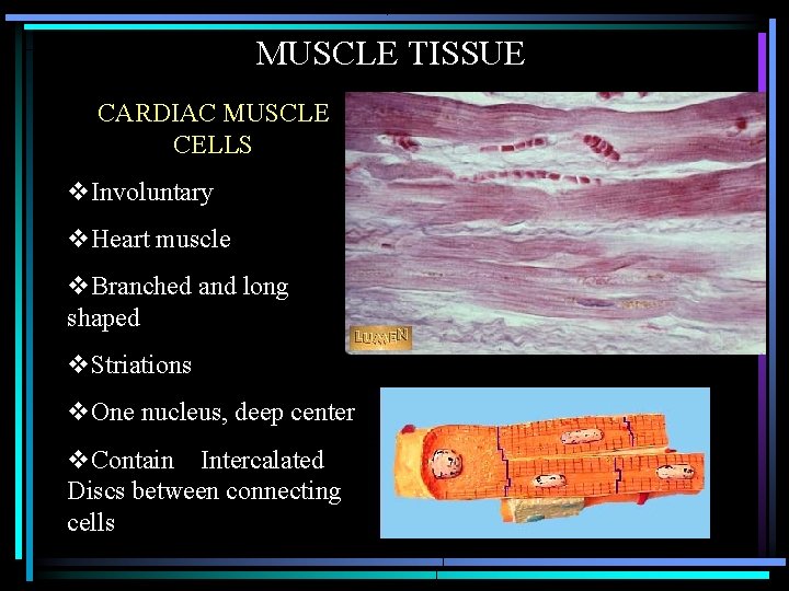 MUSCLE TISSUE CARDIAC MUSCLE CELLS v. Involuntary v. Heart muscle v. Branched and long