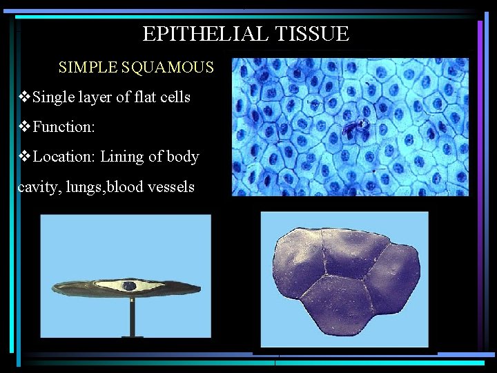 EPITHELIAL TISSUE SIMPLE SQUAMOUS v. Single layer of flat cells v. Function: v. Location: