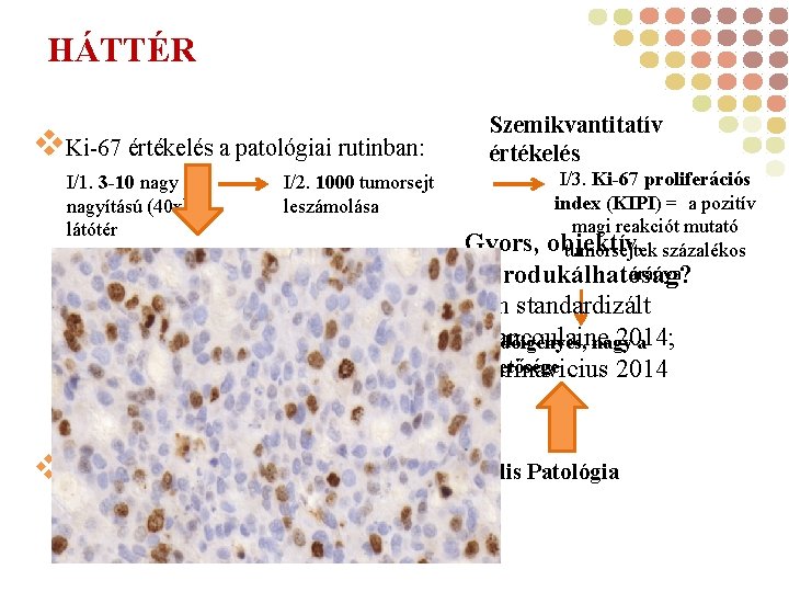 HÁTTÉR v. Ki-67 értékelés a patológiai rutinban: I/1. 3 -10 nagy I/2. 1000 tumorsejt