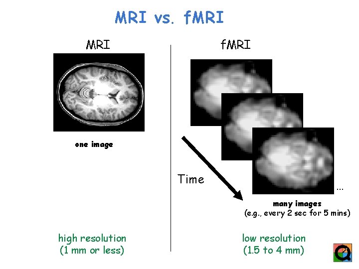 MRI vs. f. MRI one image Time … many images (e. g. , every