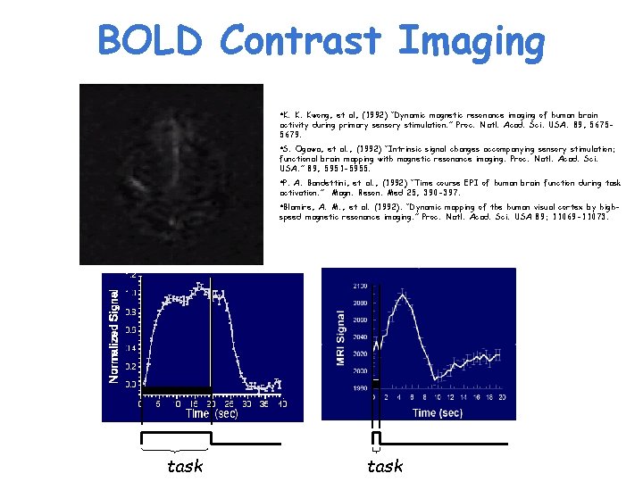 BOLD Contrast Imaging • K. K. Kwong, et al, (1992) “Dynamic magnetic resonance imaging