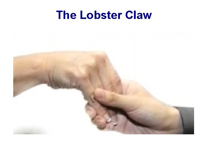 The Lobster Claw 