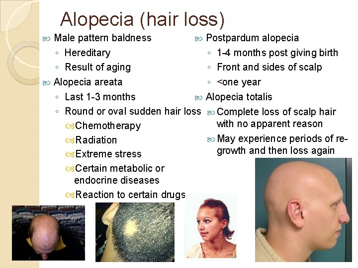 Alopecia (hair loss) Male pattern baldness Postpardum alopecia ◦ Hereditary ◦ 1 -4 months