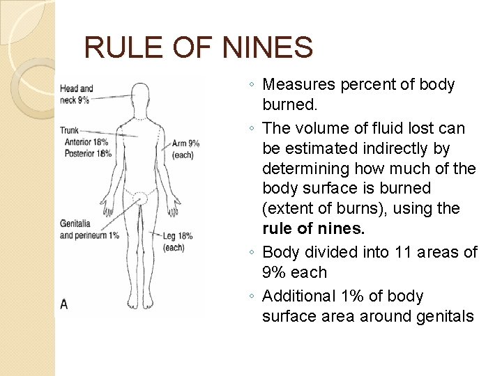 RULE OF NINES ◦ Measures percent of body burned. ◦ The volume of fluid