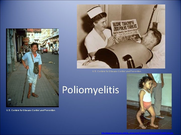 U. S. Centers for Disease Control and Prevention Poliomyelitis U. S. Centers for Disease