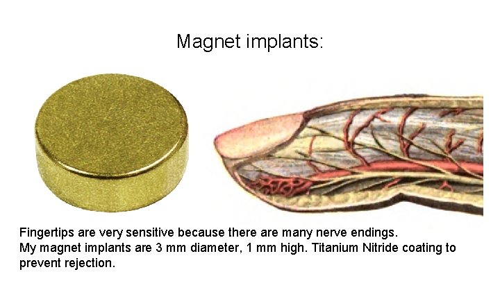 Magnet implants: Fingertips are very sensitive because there are many nerve endings. My magnet