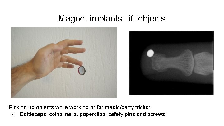 Magnet implants: lift objects Picking up objects while working or for magic/party tricks: -