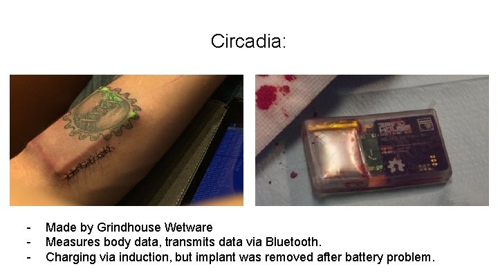 Circadia: - Made by Grindhouse Wetware Measures body data, transmits data via Bluetooth. Charging