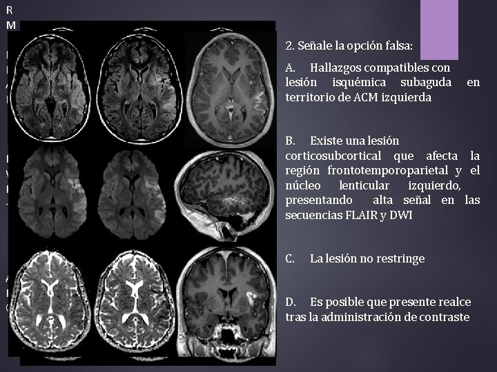 R M F L A IR D W I + 2. Señale la opción