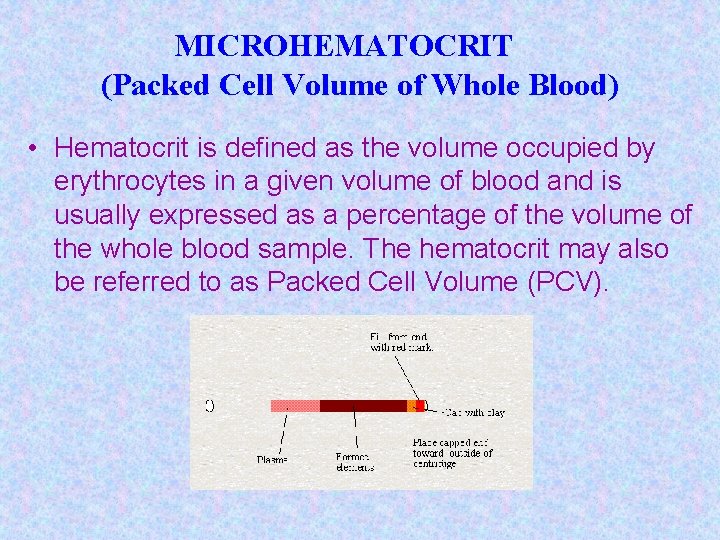 MICROHEMATOCRIT (Packed Cell Volume of Whole Blood) • Hematocrit is defined as the volume