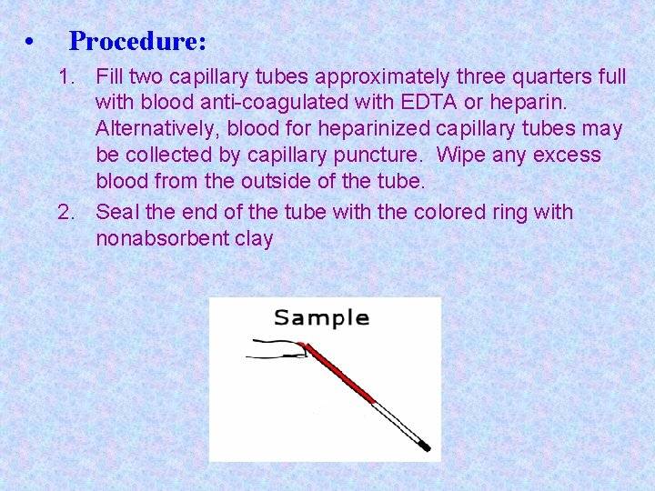  • Procedure: 1. Fill two capillary tubes approximately three quarters full with blood