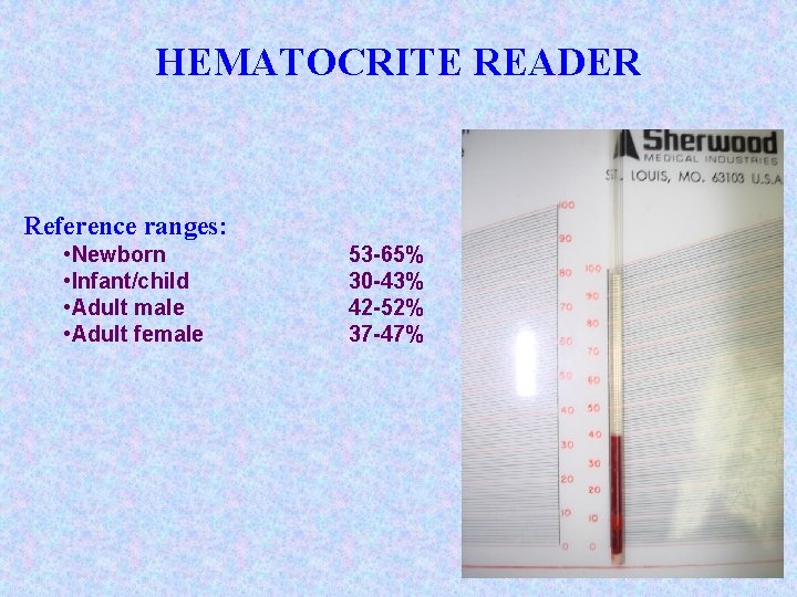 HEMATOCRITE READER Reference ranges: • Newborn • Infant/child • Adult male • Adult female