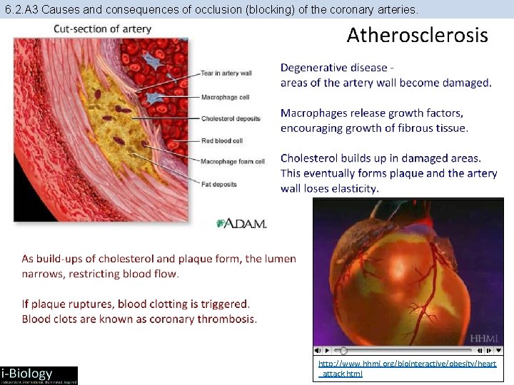 6. 2. A 3 Causes and consequences of occlusion (blocking) of the coronary arteries.