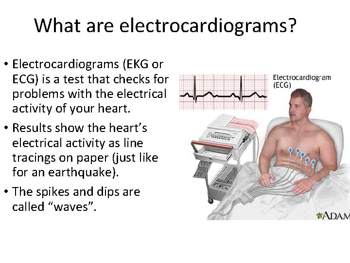 What are electrocardiograms? • Electrocardiograms (EKG or ECG) is a test that checks for