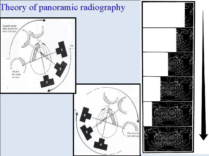 Theory of panoramic radiography Theory of panoramic radiography