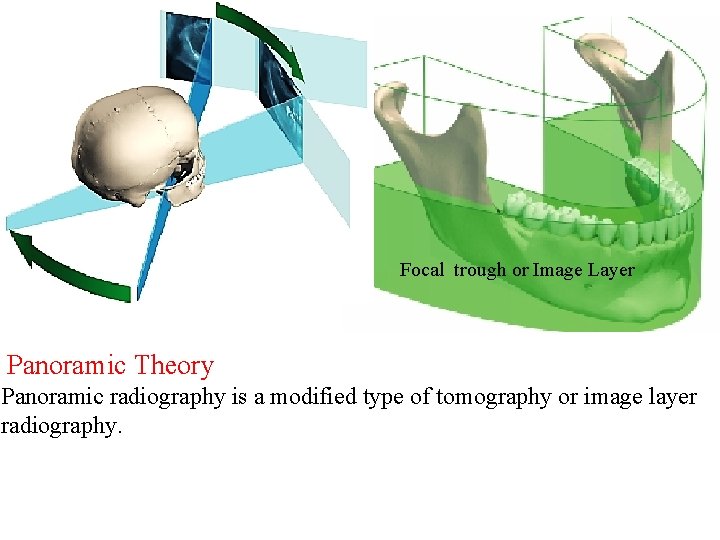 Focal trough or Image Layer Panoramic Theory Panoramic radiography is a modified type of Focal trough or Image Layer Panoramic Theory Panoramic radiography is a modified type of