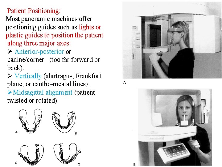 Patient Positioning: Most panoramic machines offer positioning guides such as lights or plastic guides Patient Positioning: Most panoramic machines offer positioning guides such as lights or plastic guides