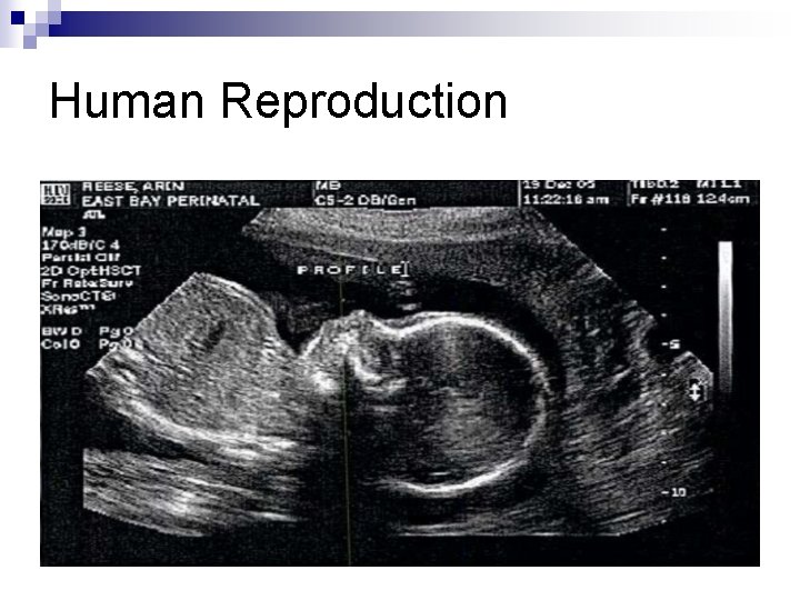 Human Reproduction 