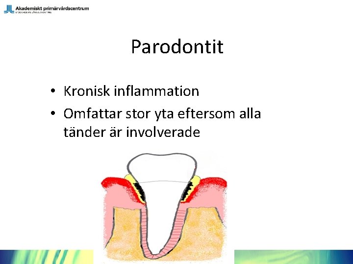Parodontit • Kronisk inflammation • Omfattar stor yta eftersom alla tänder är involverade 