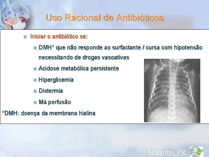 Uso Racional de Antibióticos n Iniciar o antibiótico se: n DMH* que não responde
