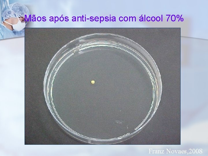 Mãos após anti-sepsia com álcool 70% Franz Novaes, 2008 