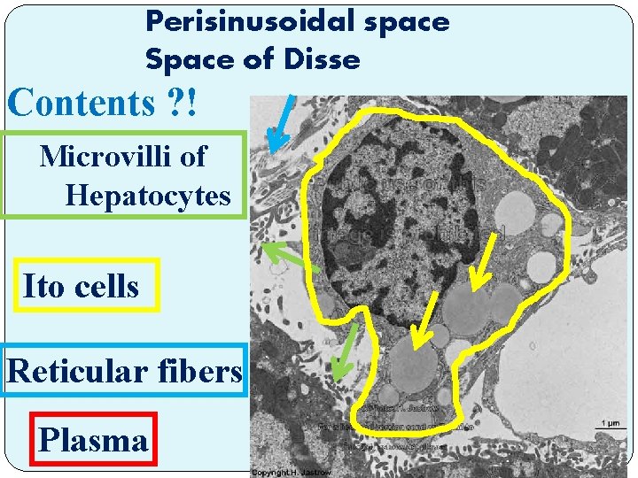 Perisinusoidal space Space of Disse Contents ? ! Microvilli of Hepatocytes Ito cells Reticular