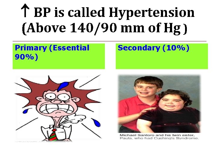  BP is called Hypertension (Above 140/90 mm of Hg ) Primary (Essential 90%)