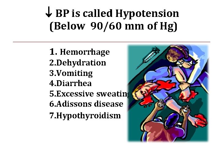  BP is called Hypotension (Below 90/60 mm of Hg) 1. Hemorrhage 2. Dehydration