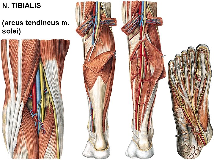 N. TIBIALIS (arcus tendineus m. solei) 