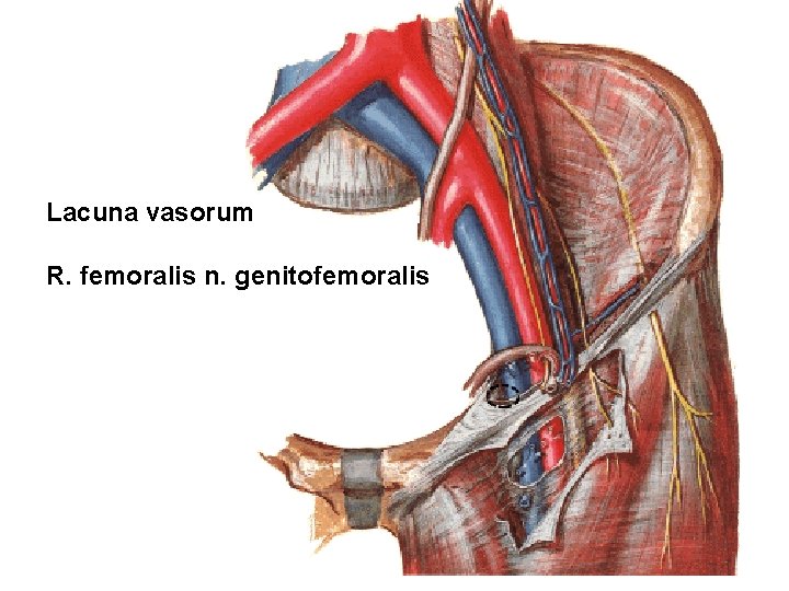 Lacuna vasorum R. femoralis n. genitofemoralis 