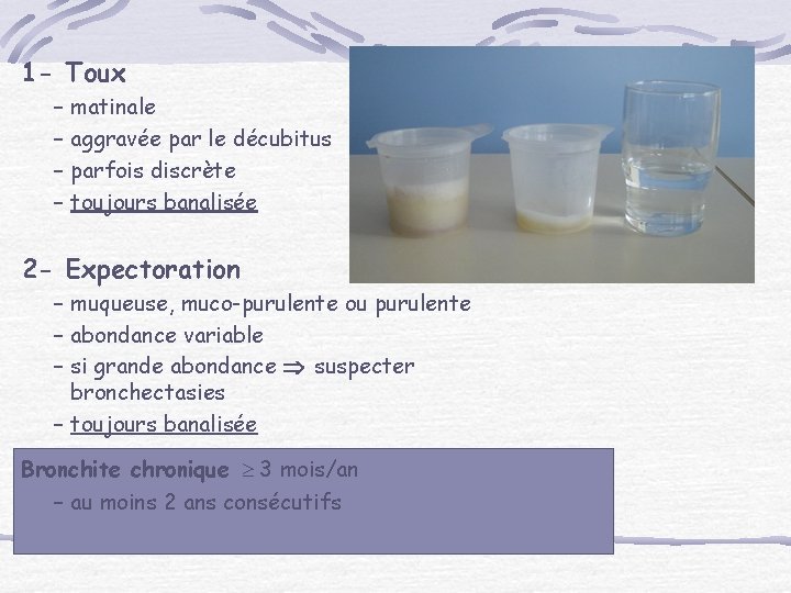 1 - Toux – matinale – aggravée par le décubitus – parfois discrète –