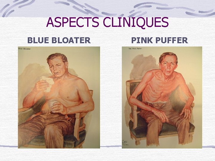 ASPECTS CLINIQUES BLUE BLOATER PINK PUFFER 