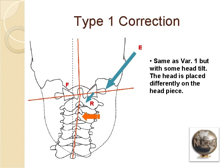 Type 1 Correction E • Same as Var. 1 but with some head tilt.