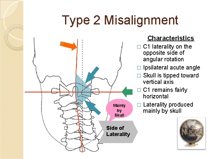 Type 2 Misalignment Characteristics C 1 laterality on the opposite side of angular rotation