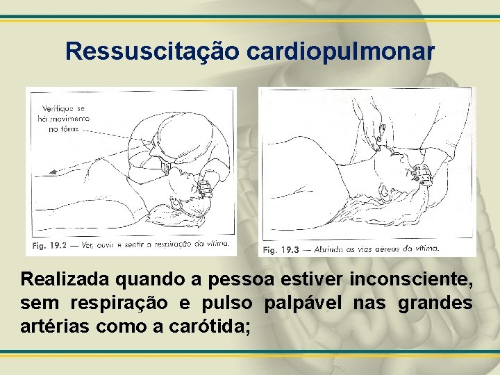 Ressuscitação cardiopulmonar Realizada quando a pessoa estiver inconsciente, sem respiração e pulso palpável nas