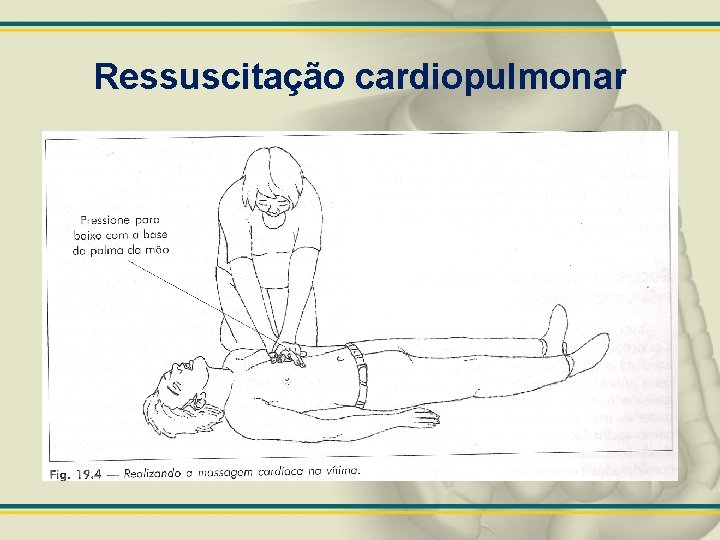 Ressuscitação cardiopulmonar 