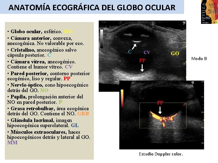 ANATOMÍA ECOGRÁFICA DEL GLOBO OCULAR • Globo ocular, esférico. GO • Cámara anterior, convexa,