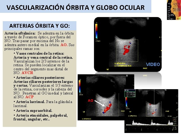 VASCULARIZACIÓN ÓRBITA Y GLOBO OCULAR ARTERIAS ÓRBITA Y GO: Arteria oftálmica: Se adentra en