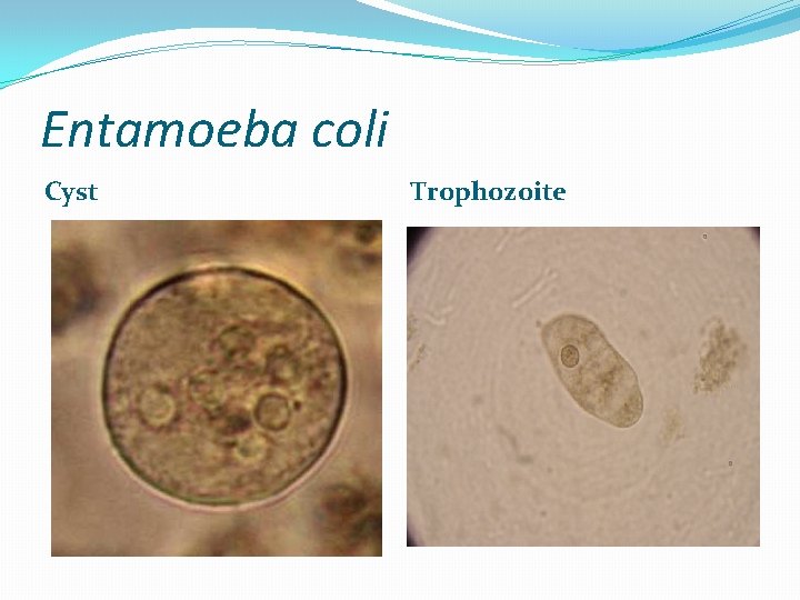 Entamoeba coli Cyst Trophozoite 