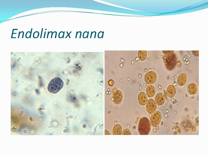Endolimax nana 