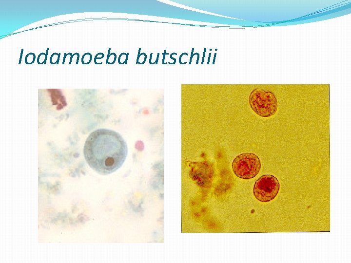 Iodamoeba butschlii 